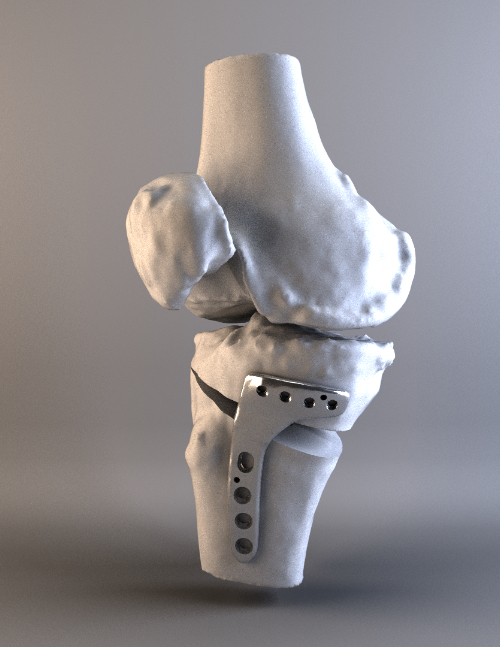 reconstrucción maxilofacial